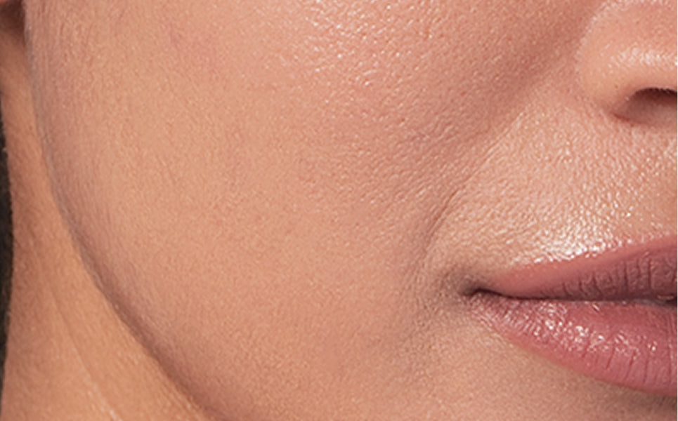 Skin after using the Hydrating Barrier Cream