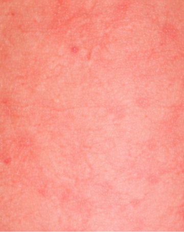 sensitive texture