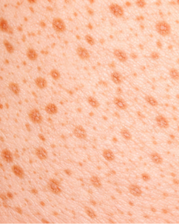 combination texture