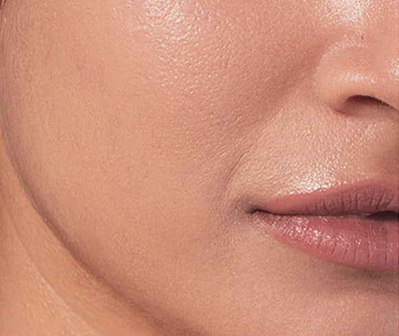 Skin after using the Hydrating Barrier Cream